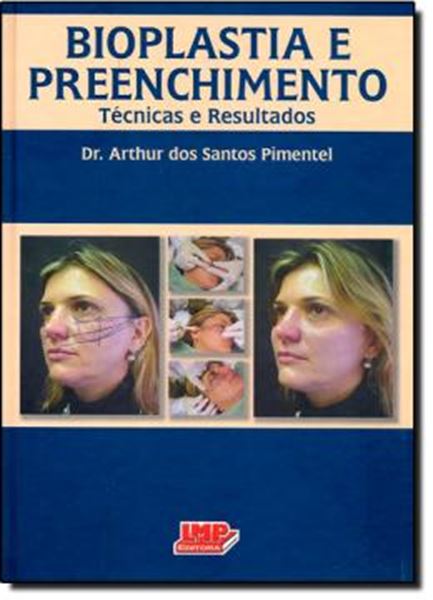 Picture of BIOPLASTIA E PREENCHIMENTO - TECNICAS E RESULTADOS - 2º ED