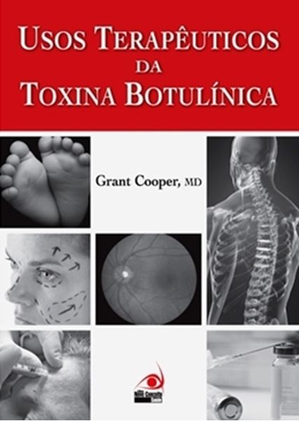 Picture of USOS TERAPEUTICOS DA TOXINA BOTULINICA