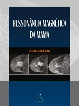 Imagem de RESSONANCIA MAGNETICA DA MAMA