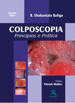Imagem de COLPOSCOPIA - PRINCIPIOS E PRATICA - 2ª ED