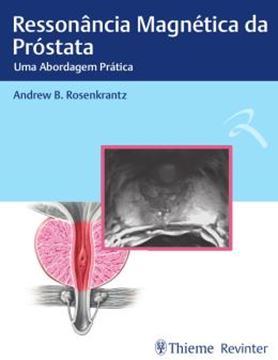 Imagem de RESSONANCIA MAGNETICA DA PROSTATA 