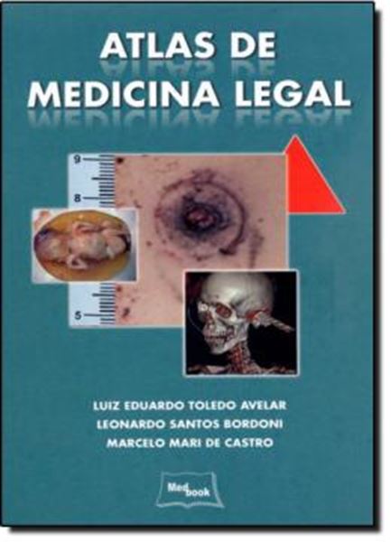 Picture of ATLAS DE MEDICINA LEGAL