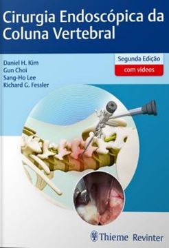 Imagem de CIRURGIA ENDOSCOPICA DA COLUNA VERTEBRAL - 2ª ED