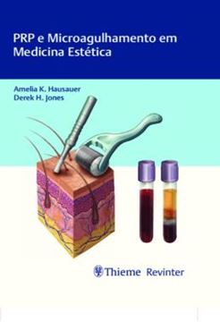 Imagem de PRP E MICROAGULHAMENTO EM MEDICINA ESTETICA