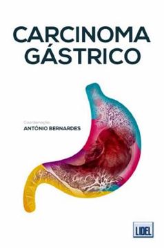 Imagem de CARCINOMA GASTRICO